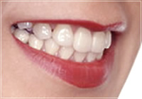 歯と口の総合精密検査のイメージ